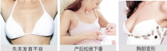 豐胸霜怎么用？豐胸霜使用手法詳解