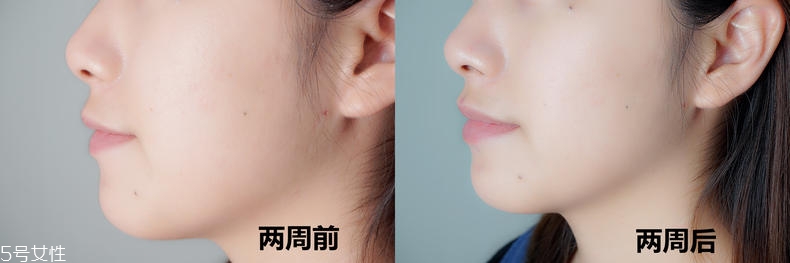 歐緹麗美白精華水怎么樣 歐緹麗美白精華水真人實(shí)測(cè)