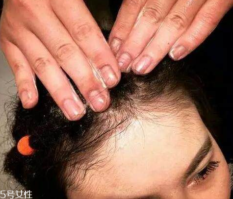 臟辮多久洗一次 臟辮是這樣養(yǎng)護的 臟辮多久洗一次 臟辮是這樣養(yǎng)護的