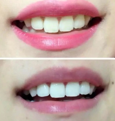 mistine美牙筆怎么用？mistine美牙筆評(píng)測(cè)