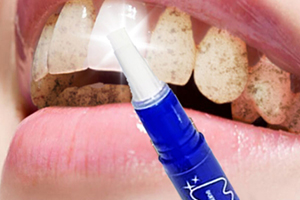 mistine美牙筆怎么用？mistine美牙筆評(píng)測(cè)