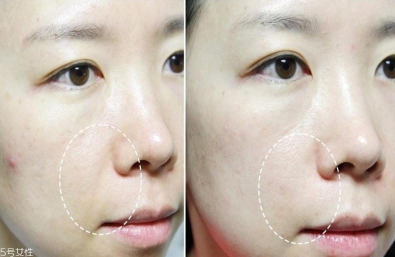 萊珀妮魚子緊顏液適合什么人 LP藍魚子精華推薦膚質(zhì) 萊珀妮魚子緊顏液適合什么人 LP藍魚子精華推薦膚質(zhì)