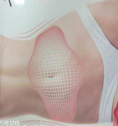 瘦身貼什么時候用最好？瘦身貼最佳使用時間