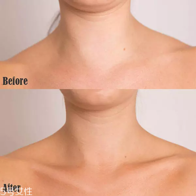 唇部遮瑕膏可以用什么代替 遮瑕膏的9種妙法 唇部遮瑕膏可以用什么代替 遮瑕膏的9種妙法