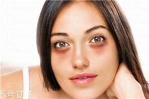 熊貓眼怎么消退 去除熊貓眼4大技巧 熊貓眼怎么消退 去除熊貓眼4大技巧