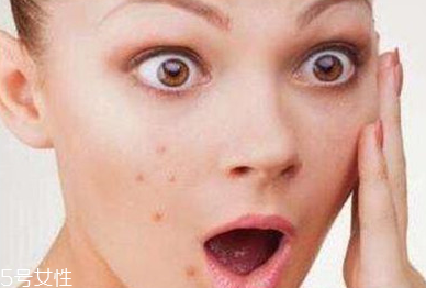 痘痘肌怎么使用卸妝油 痘痘肌用卸妝油的注意點 痘痘肌怎么使用卸妝油 痘痘肌用卸妝油的注意點
