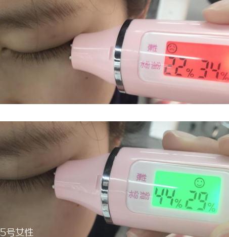 菲洛嘉眼霜敏感肌能用嗎 菲洛嘉360眼霜真人實(shí)測 菲洛嘉眼霜敏感肌能用嗎 菲洛嘉360眼霜真人實(shí)測