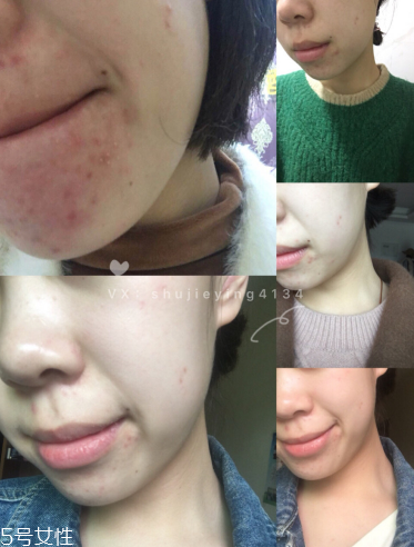 伊索綠茶平衡調理液和無油精華露哪個好 伊索綠茶平衡調理液和無油精華露哪個好