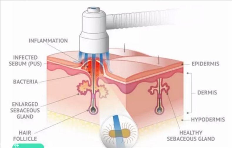 干性肌膚怎么抗皺 干性肌抗皺注意三點(diǎn) 干性肌膚怎么抗皺 干性肌抗皺注意三點(diǎn)
