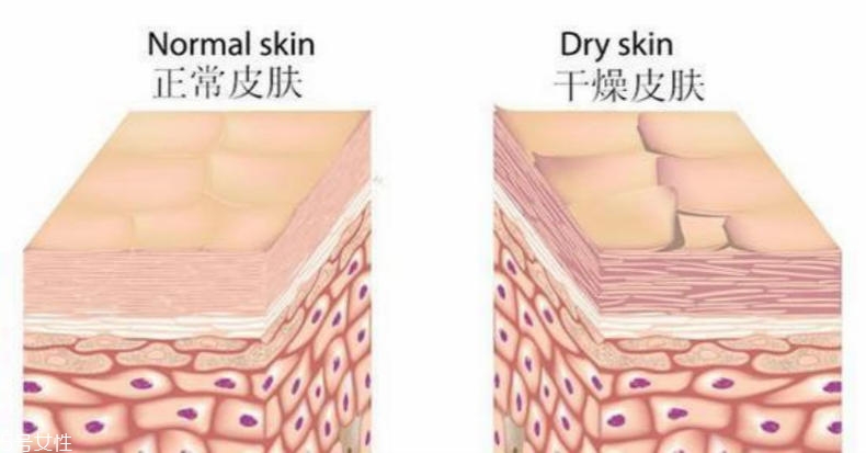 干性肌膚怎么抗皺 干性肌抗皺注意三點(diǎn) 干性肌膚怎么抗皺 干性肌抗皺注意三點(diǎn)