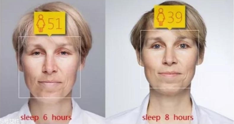 干性肌膚怎么抗皺 干性肌抗皺注意三點(diǎn) 干性肌膚怎么抗皺 干性肌抗皺注意三點(diǎn)