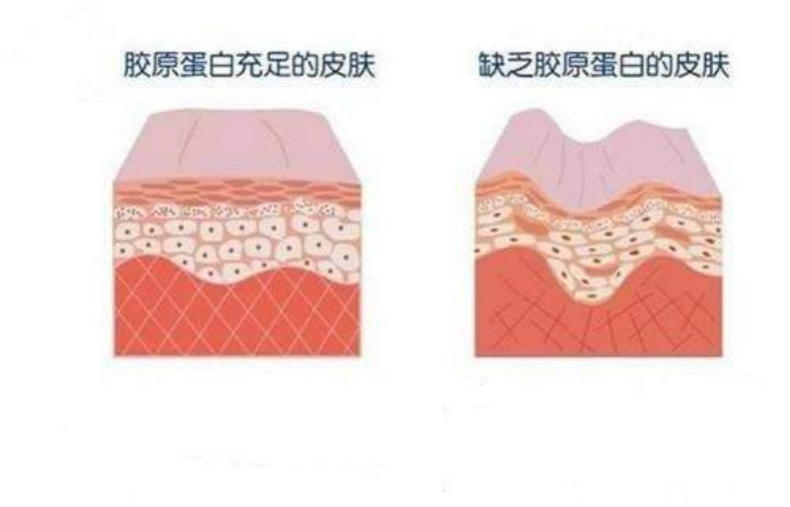 干性肌膚怎么抗皺 干性肌抗皺注意三點(diǎn) 干性肌膚怎么抗皺 干性肌抗皺注意三點(diǎn)