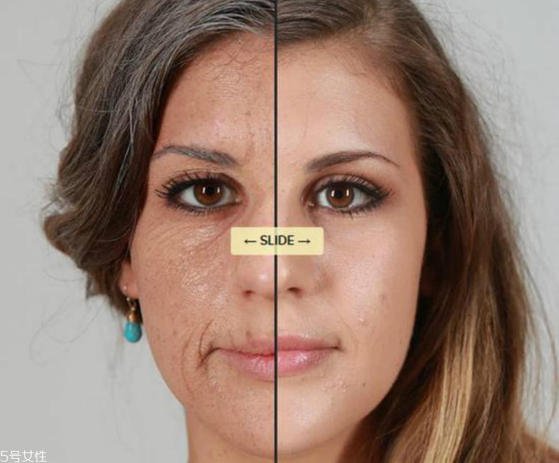 干性肌膚怎么抗皺 干性肌抗皺注意三點(diǎn) 干性肌膚怎么抗皺 干性肌抗皺注意三點(diǎn)