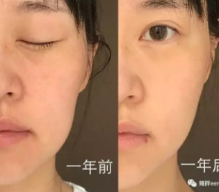 童顏機(jī)有用嗎？童顏機(jī)的功效