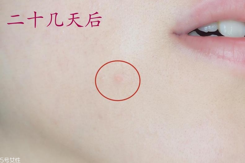 雅詩蘭黛晶透沁白防曬搖搖乳成膜快嗎？適合油痘皮嗎？