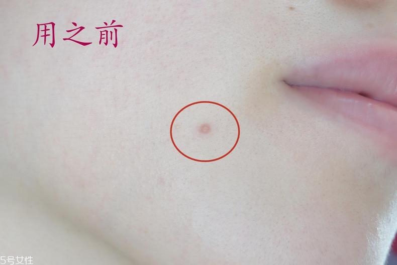 雅詩蘭黛晶透沁白防曬搖搖乳成膜快嗎？適合油痘皮嗎？