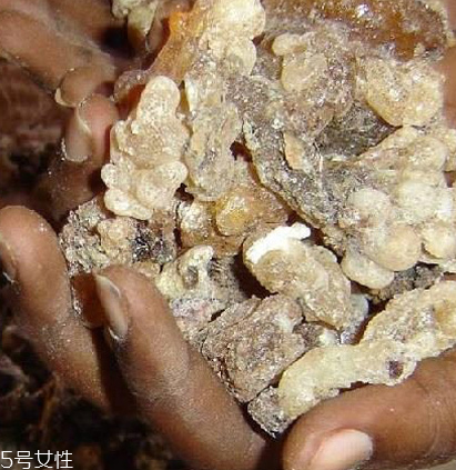 乳香純露的功效與作用 乳香純露的美容功效 乳香純露的功效與作用 乳香純露的美容功效