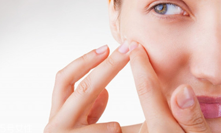 黑色痘印如何去除 去痘印一定要做好防曬措施 黑色痘印如何去除 去痘印一定要做好防曬措施