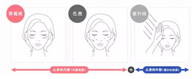 祛斑美白什么產(chǎn)品最有效 日常祛斑小妙招 祛斑美白什么產(chǎn)品最有效 日常祛斑小妙招