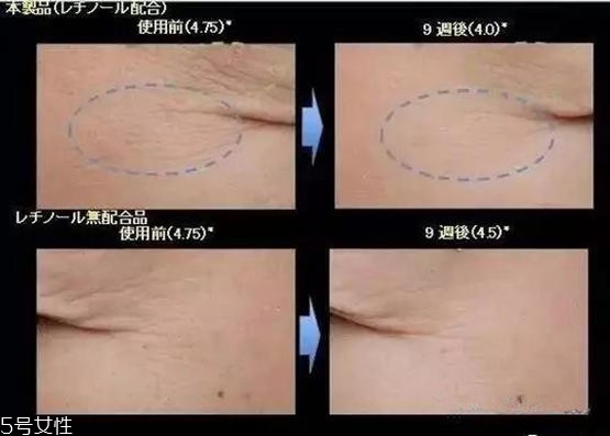 怡麗絲爾撫紋眼霜什么味道 怡麗絲爾撫紋眼霜香味 怡麗絲爾撫紋眼霜什么味道 怡麗絲爾撫紋眼霜香味