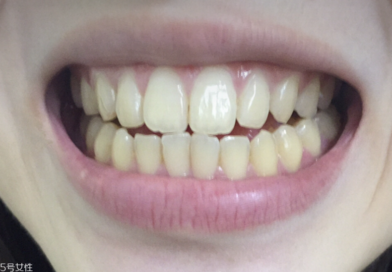 中華美白牙膏真的能美白嗎 中華美白牙膏評測 中華美白牙膏真的能美白嗎 中華美白牙膏評測