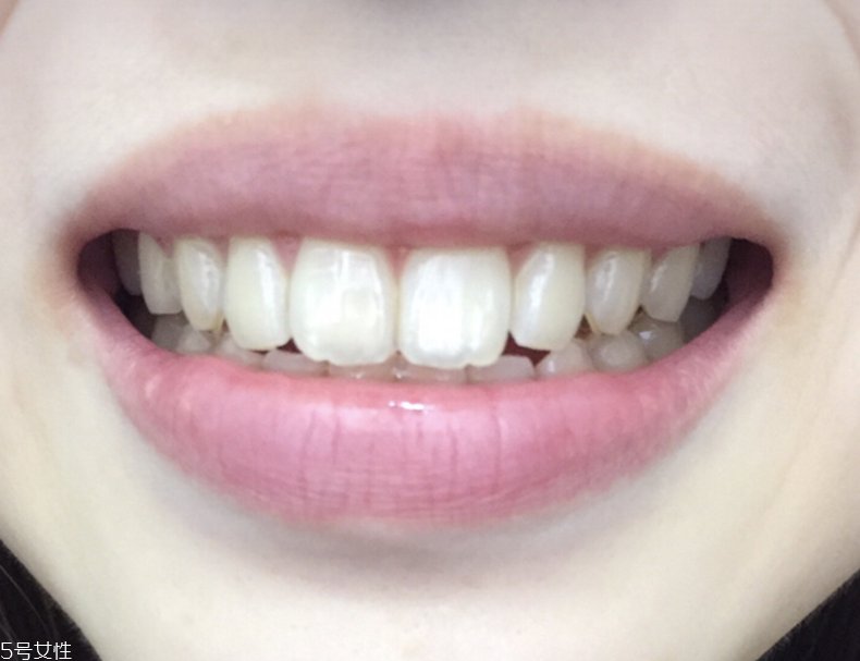 中華美白牙膏真的能美白嗎 中華美白牙膏評測 中華美白牙膏真的能美白嗎 中華美白牙膏評測