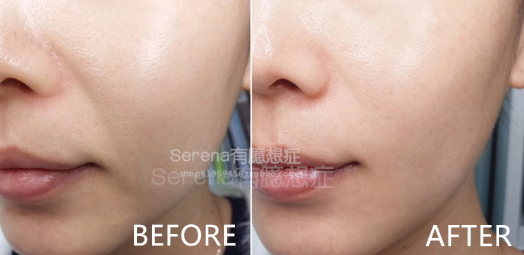 dermawand逆齡射頻注氧棒怎么用？