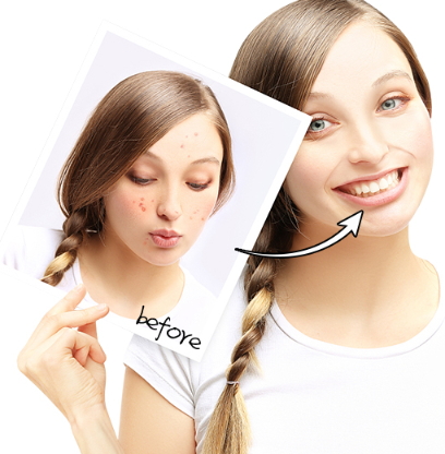 導(dǎo)出儀器真的有用嗎？導(dǎo)出儀的功效