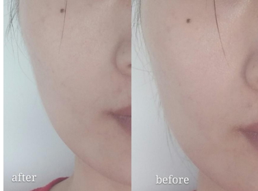 ulike美容儀怎么用？ulike美容儀充電