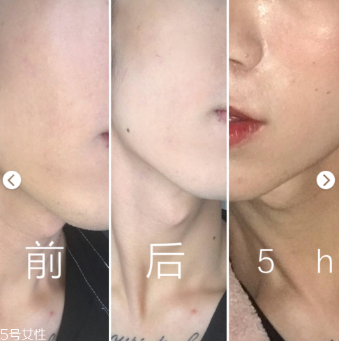 becca水散粉油皮可以用嗎 becca hydra mist保濕散粉 becca水散粉油皮可以用嗎 becca hydra mist保濕散粉