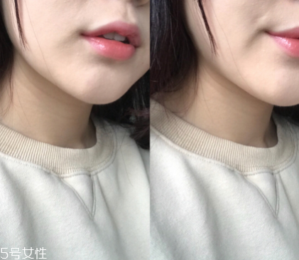 dodo label隱形瘦臉貼好用嗎 韓國ins網(wǎng)紅爆款瘦臉神器 dodo label隱形瘦臉貼好用嗎 韓國ins網(wǎng)紅爆款瘦臉神器