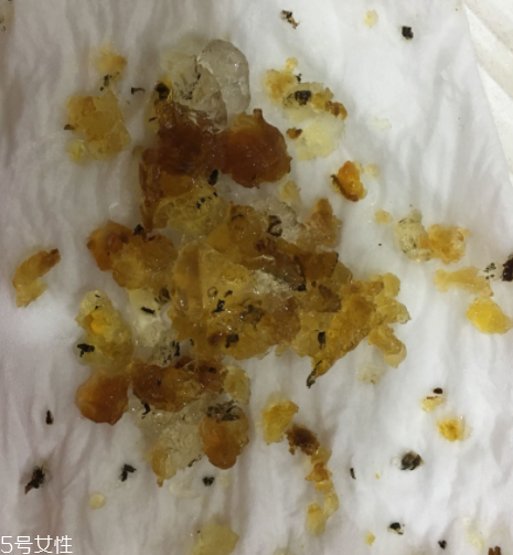 桃膠能和雞蛋一起吃嗎？桃膠配雞蛋可以嗎？