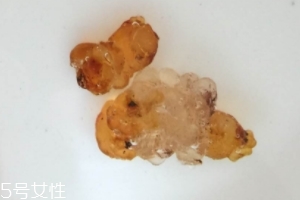 桃膠可以用開水泡嗎？用開水泡桃膠好嗎？