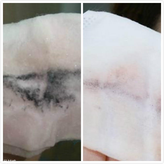 notime美容儀真的有效嗎 notime美容儀2個月親測 notime美容儀真的有效嗎 notime美容儀2個月親測