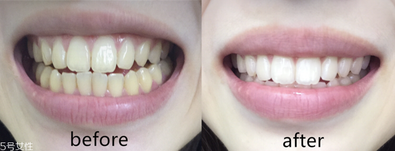 美白牙膏佳潔士和中華哪個好 美白牙膏佳潔士vs中華 美白牙膏佳潔士和中華哪個好 美白牙膏佳潔士vs中華