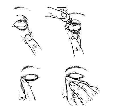 眼藥水兒童可以用嗎？眼藥水適合兒童用嗎？