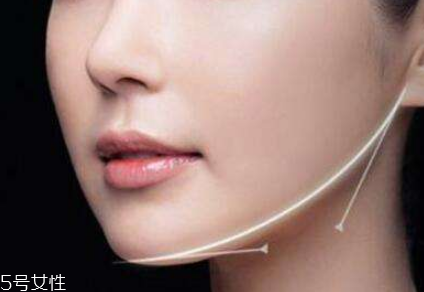 粉毒瘦臉針能維持多久？粉毒瘦臉針能保持多長時間