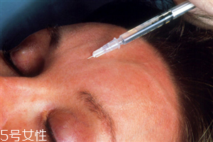 水光針和美白針哪個好 水光針和美白針能一起打嗎 水光針和美白針哪個好 水光針和美白針能一起打嗎