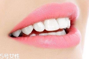 超聲波潔牙牙齒會變白嗎？超聲波潔牙心得