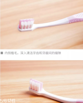 超聲波潔牙牙齒會變白嗎？超聲波潔牙心得