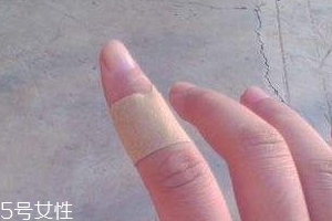 創(chuàng)可貼可以消腫嗎？創(chuàng)可貼有消腫功效嗎？