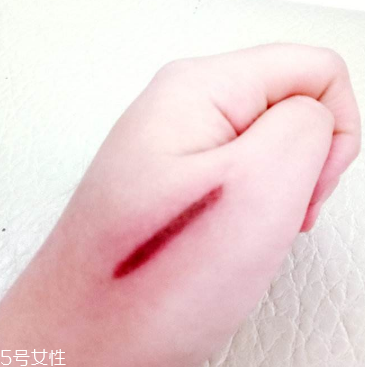 創(chuàng)可貼和肉連著怎么辦？創(chuàng)可貼連著肉怎么處理？