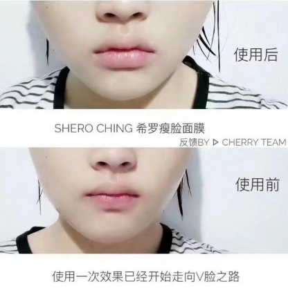 希羅瘦臉面膜多少錢 希羅瘦臉面膜代理價 希羅瘦臉面膜多少錢 希羅瘦臉面膜代理價