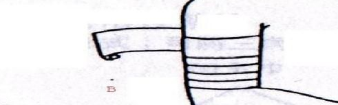 醫(yī)用紗布怎么固定？醫(yī)用紗布怎么包扎？