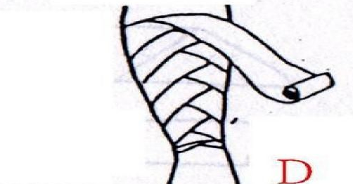 醫(yī)用紗布怎么固定？醫(yī)用紗布怎么包扎？