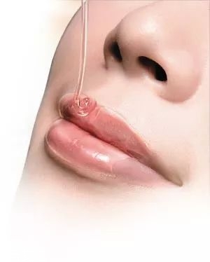 唇部周?chē)党猎趺崔k 唇周暗沉如何改善 唇部周?chē)党猎趺崔k 唇周暗沉如何改善