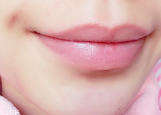 唇色深怎么辦 唇色深的改善方法 唇色深怎么辦 唇色深的改善方法