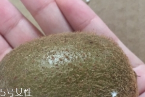 綠心獼猴桃含葉酸嗎？綠心獼猴桃里面有葉酸嗎？