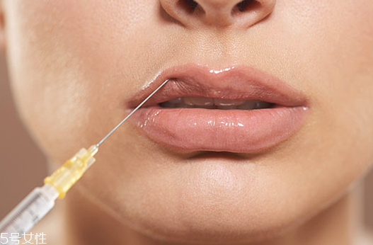 玻尿酸豐唇一周不變軟是什么原因 玻尿酸豐唇后要注意 玻尿酸豐唇一周不變軟是什么原因 玻尿酸豐唇后要注意