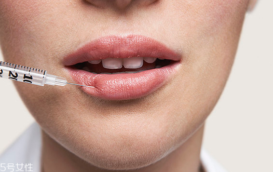 玻尿酸豐唇一周不變軟是什么原因 玻尿酸豐唇后要注意 玻尿酸豐唇一周不變軟是什么原因 玻尿酸豐唇后要注意